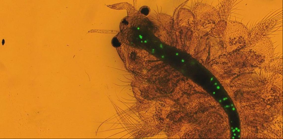 Entenda como microplásticos representam riscos à saúde das pessoas e do planeta